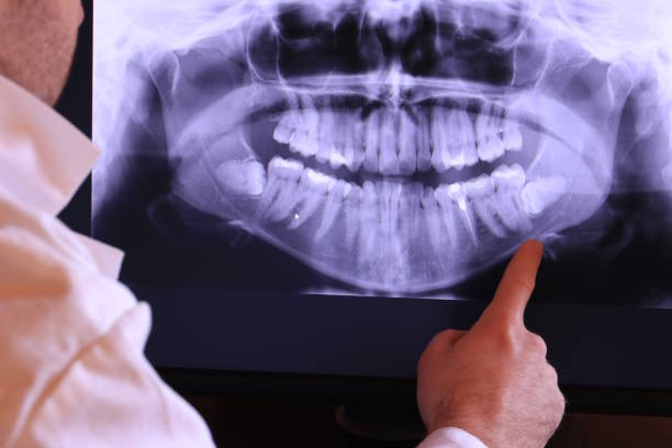 Best After-Hours Emergency Dentist in Covgton, IN