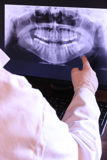 Best Emergency Tooth Extraction in Covgton, IN